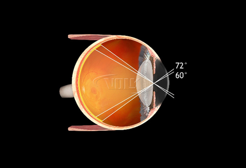 Volk Digital 1,0x Imaging von Volk – Onlineshop für Augenärzte, Kliniken, Optiker & Händler | Ophthal-Optics