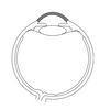 Haag-Streit Kontaktglas Eisner 1210 von Haag Streit – Onlineshop für Augenärzte, Kliniken, Optiker & Händler | Ophthal-Optics