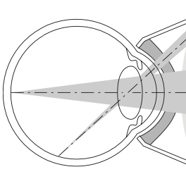 Haag-Streit Kontaktglas Retina 145L von Haag Streit – Onlineshop für Augenärzte, Kliniken, Optiker & Händler | Ophthal-Optics