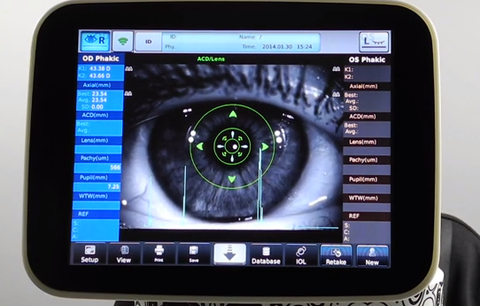 Optisches Biometriesystem Tomey OA-2000 von Tomey – Onlineshop für Augenärzte, Kliniken, Optiker & Händler | Ophthal-Optics