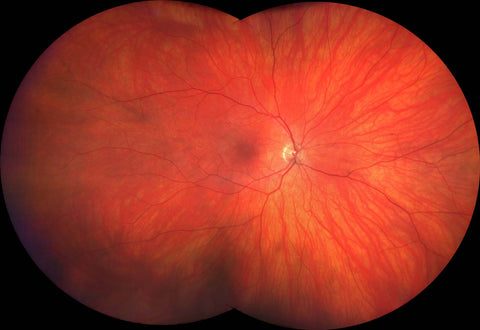 Zeiss Clarus 500 Ultraweitwinkel von Zeiss – Anfrage für Augenärzte, Kliniken, Optiker & Händler | Ophthal-Optics