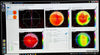 Cassini Corneal Topographer